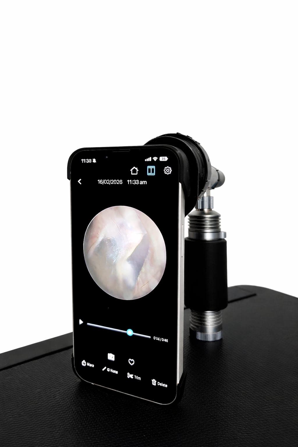 Close-up ear inspection with professional equipment